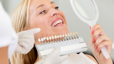 dentist-teeth-whitening Dentist teeth whitening