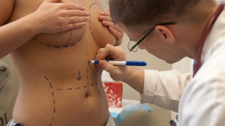 Kim is desperate for breast reduction surgery (stock image) Kim is desperate for breast reduction surgery (stock image)