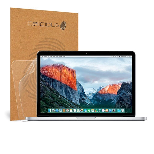 Celicious, Matte Anti-Glare Screen Protector Film, £16.96