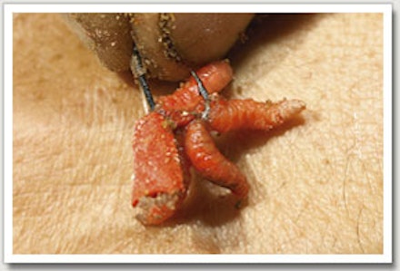 8. Add three, four or five red maggots to the hook to complete the hookbait. Tench love red maggots. 8. Add three, four or five red maggots to the hook to complete the hookbait. Tench love red maggots.