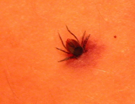 tick tick