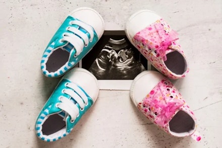 babyscan