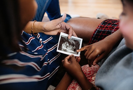 Young couple looking at pregnancy trimester ultrasound scan photo