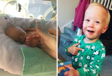 charlie-then-now-preemie charlie-then-now-preemie