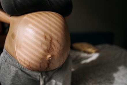 Waiting for a baby pregnant woman with stretch marks on tummy