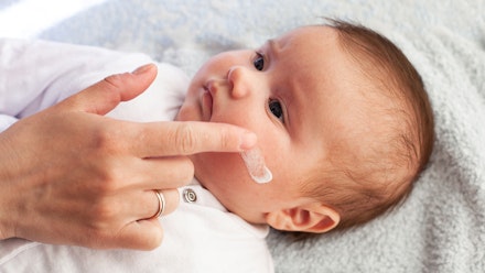 baby-eczema-cream