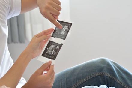 ultra sound