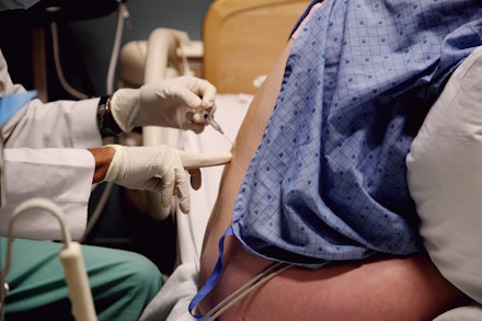 epidural what happens