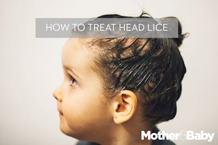 headlice How to treat head lice
