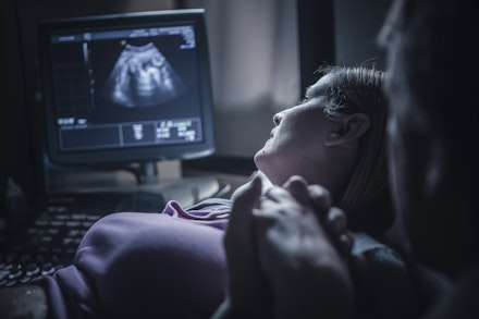 sonogram scan1
