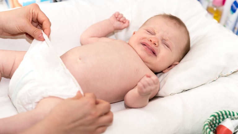 Balanitis in babies: Causes, symptoms, and treatment