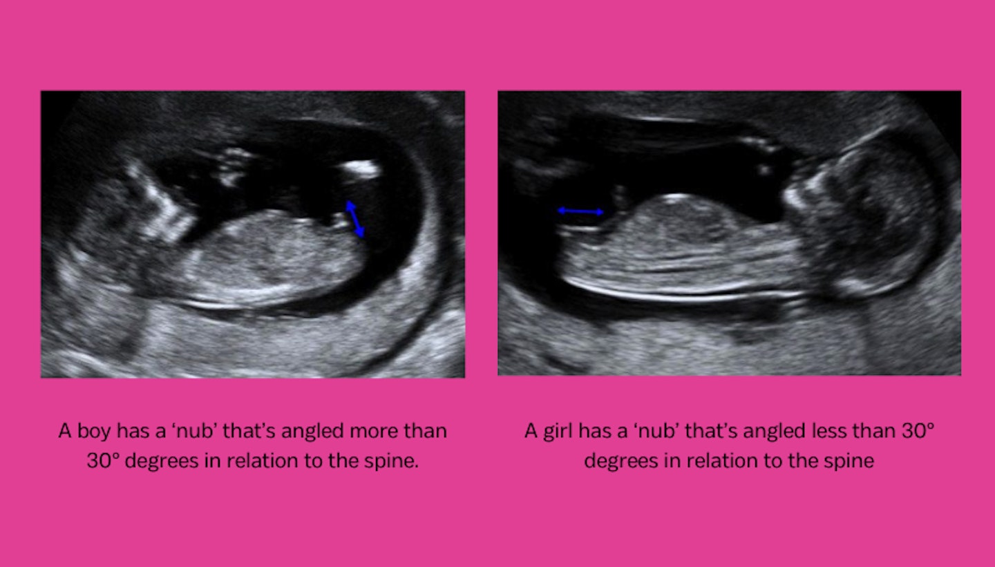 copies of baby ultra sound scan on pink background