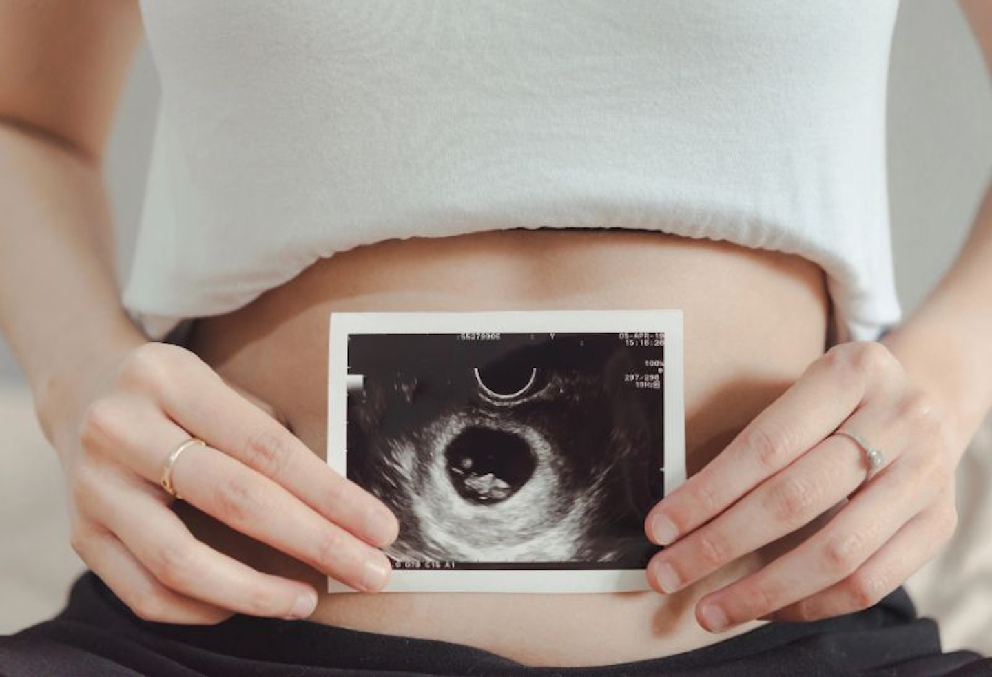 A view of a woman's tummy with small bump, holding a 8 week scan image in front