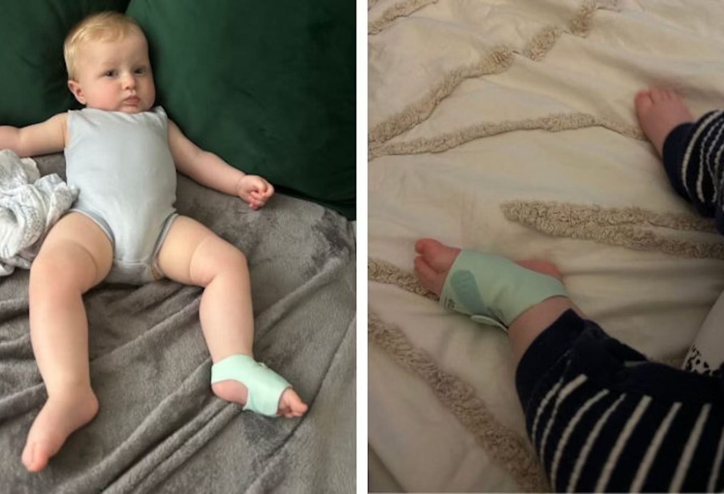 Baby wearing the Owlet Dream Sock