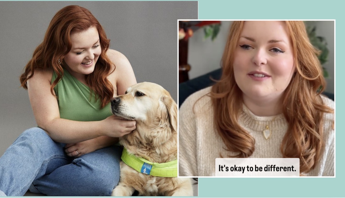 image collage of Lucy Edwards blind social media activist who is losing weight to qualify for NHS IVF
