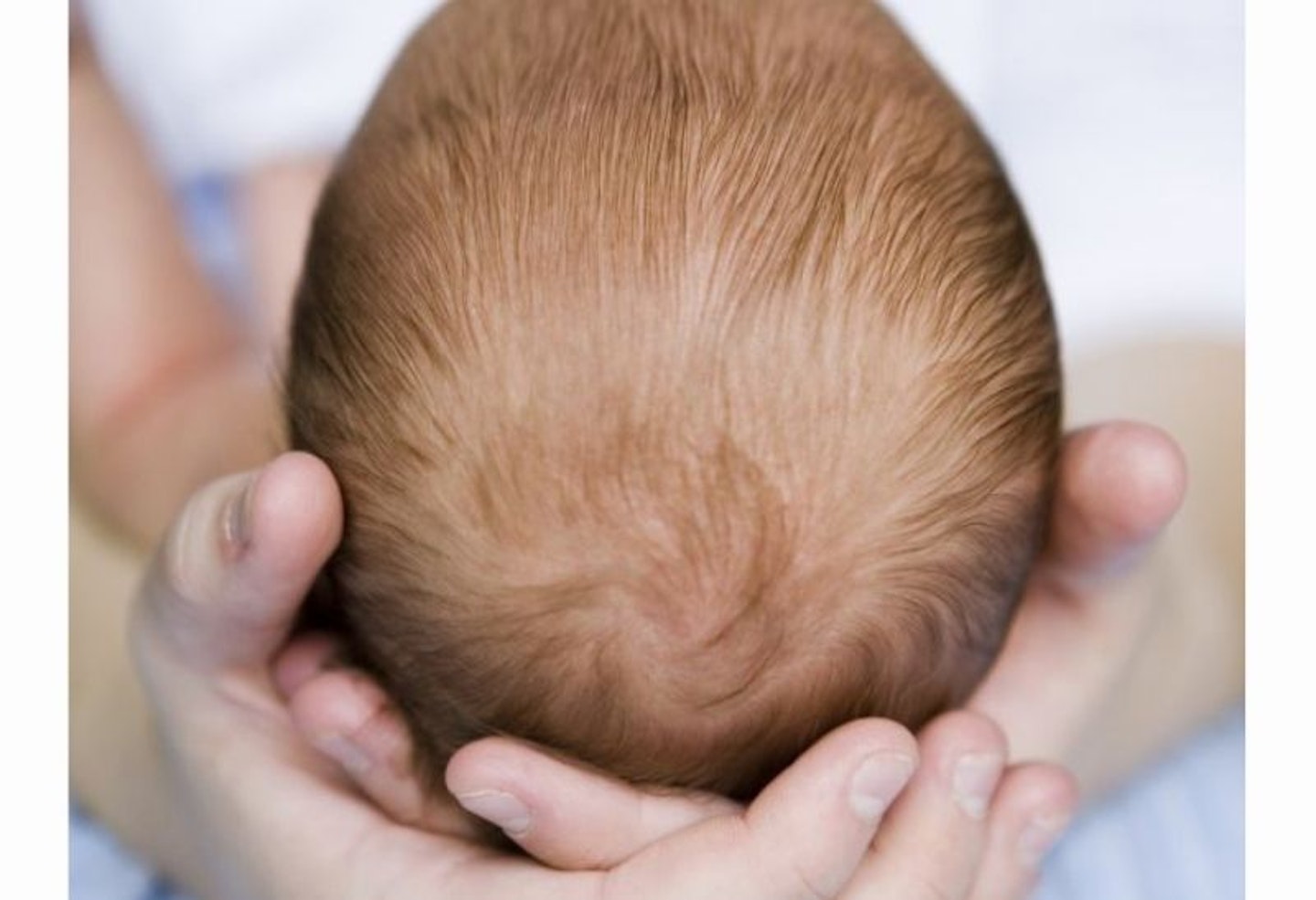 Cradle cap