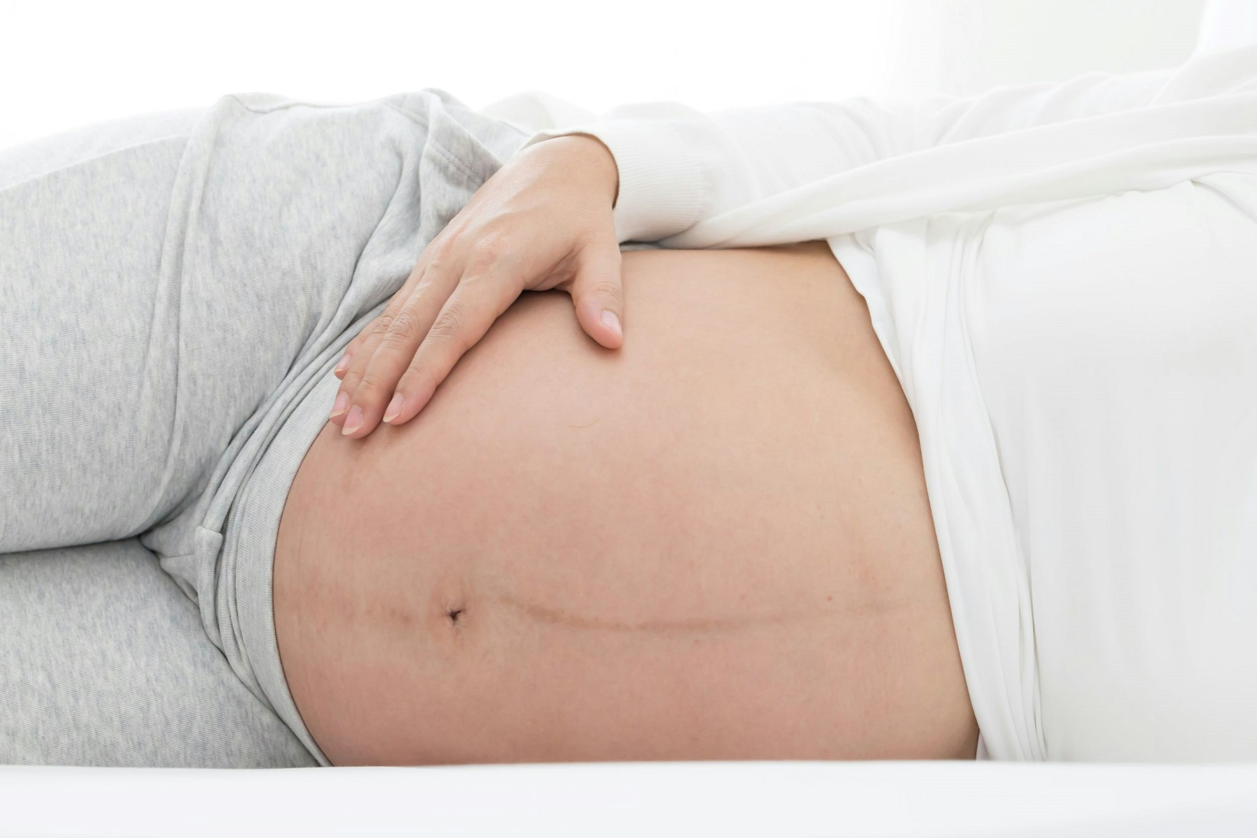 Early pregnancy line on the stomach - Linea Nigra