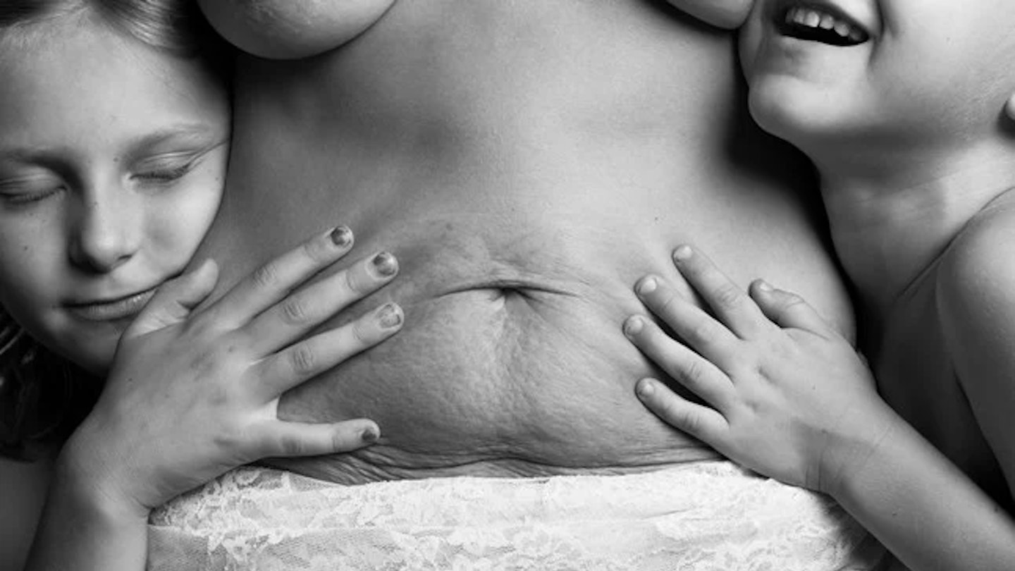 Gallery: What Real Mums’ Bodies Look Like After Having Children – It’s Time To Embrace Those Stretch Marks And Celebrate The Mum-Tum!