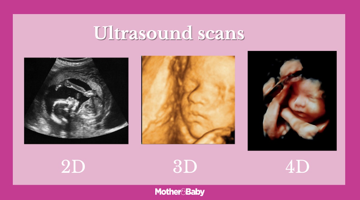 3D baby scan What is it and how does it work? Pregnancy Mother & Baby