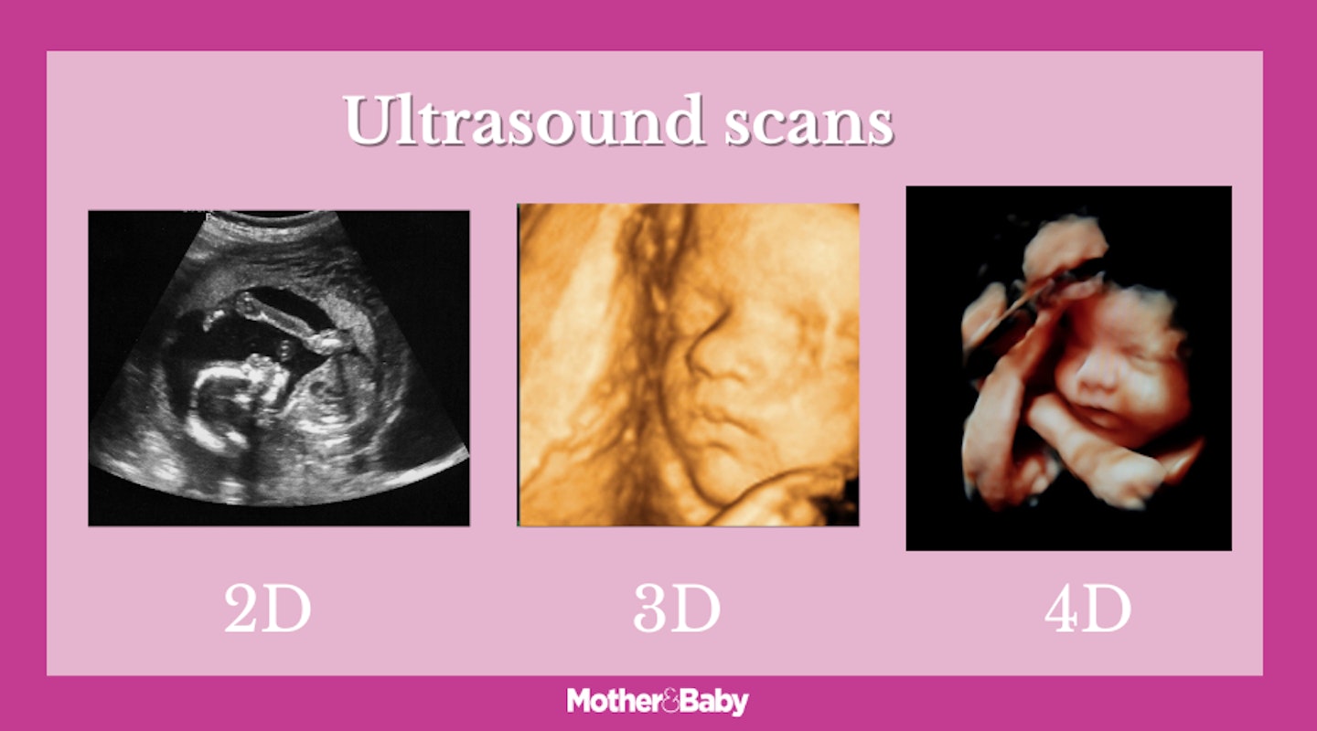 2D scan, 3D scan and 4D scan