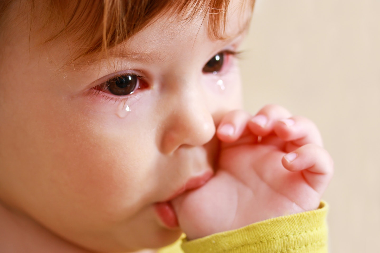 toddler crying with sore eyes