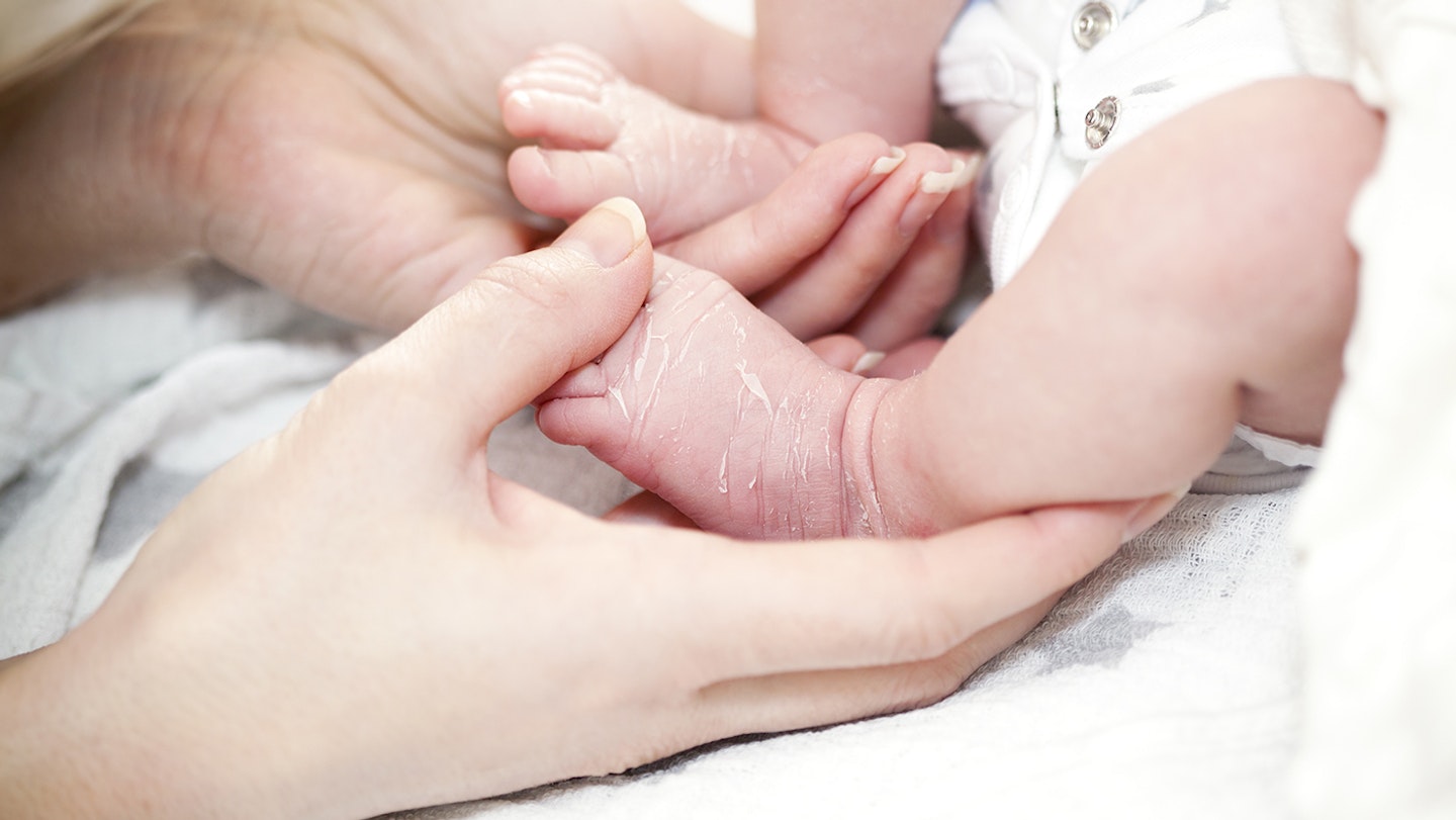newborn-skin-peeling