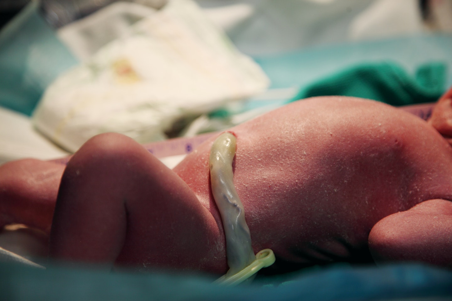 Umbilical cord cutting: everything you need to know