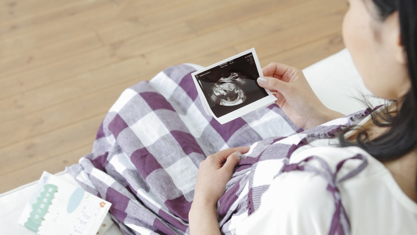 Your Pregnancy Ultrasound Scan Photo Explained