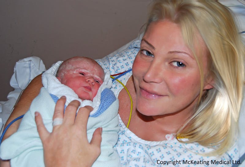 I had a natural c-section Pregnancy Mother and Baby