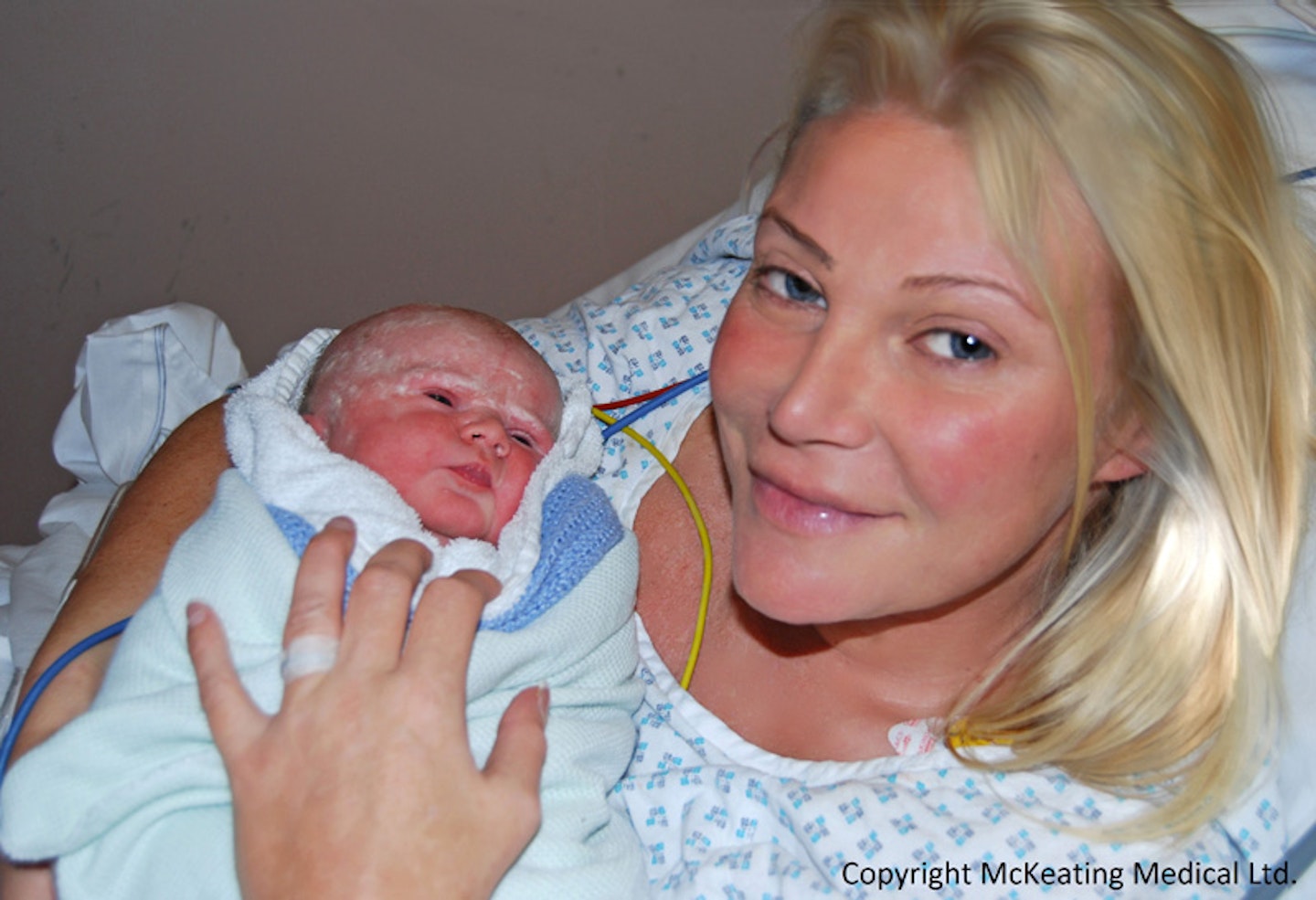 ‘I had a natural c-section’