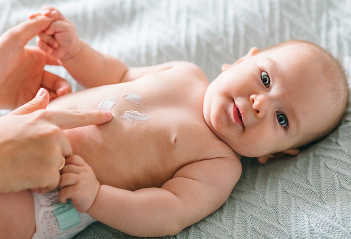 eczema cream for babies