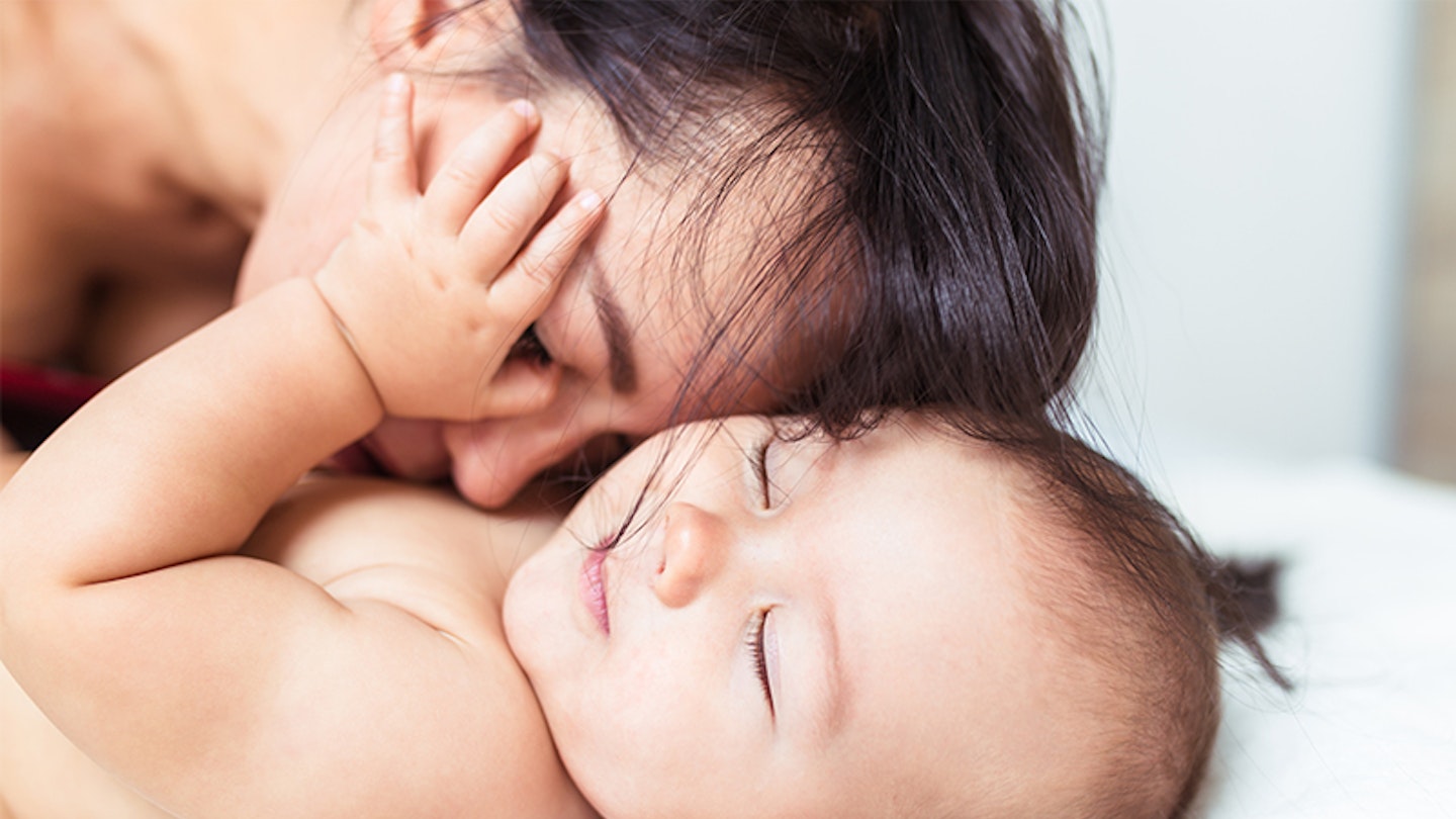 Baby skin trouble? How to spot common conditions