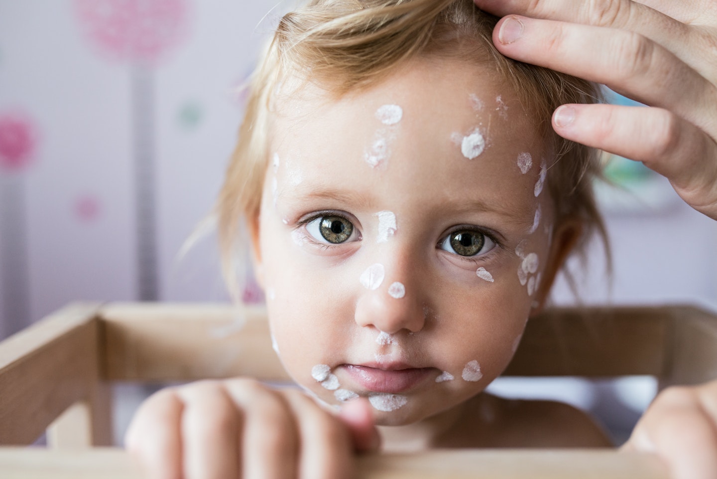 Everything you need to know about Chicken pox
