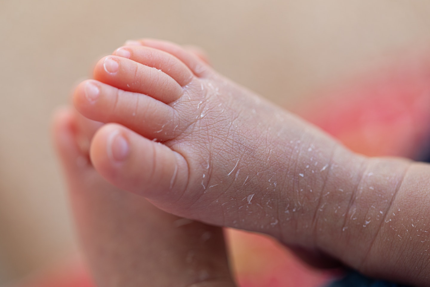 Dry skin - oatmeal bath