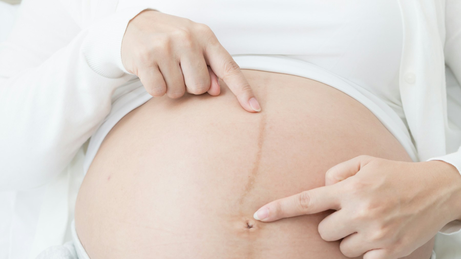 Do All Belly Buttons Pop In Pregnancy