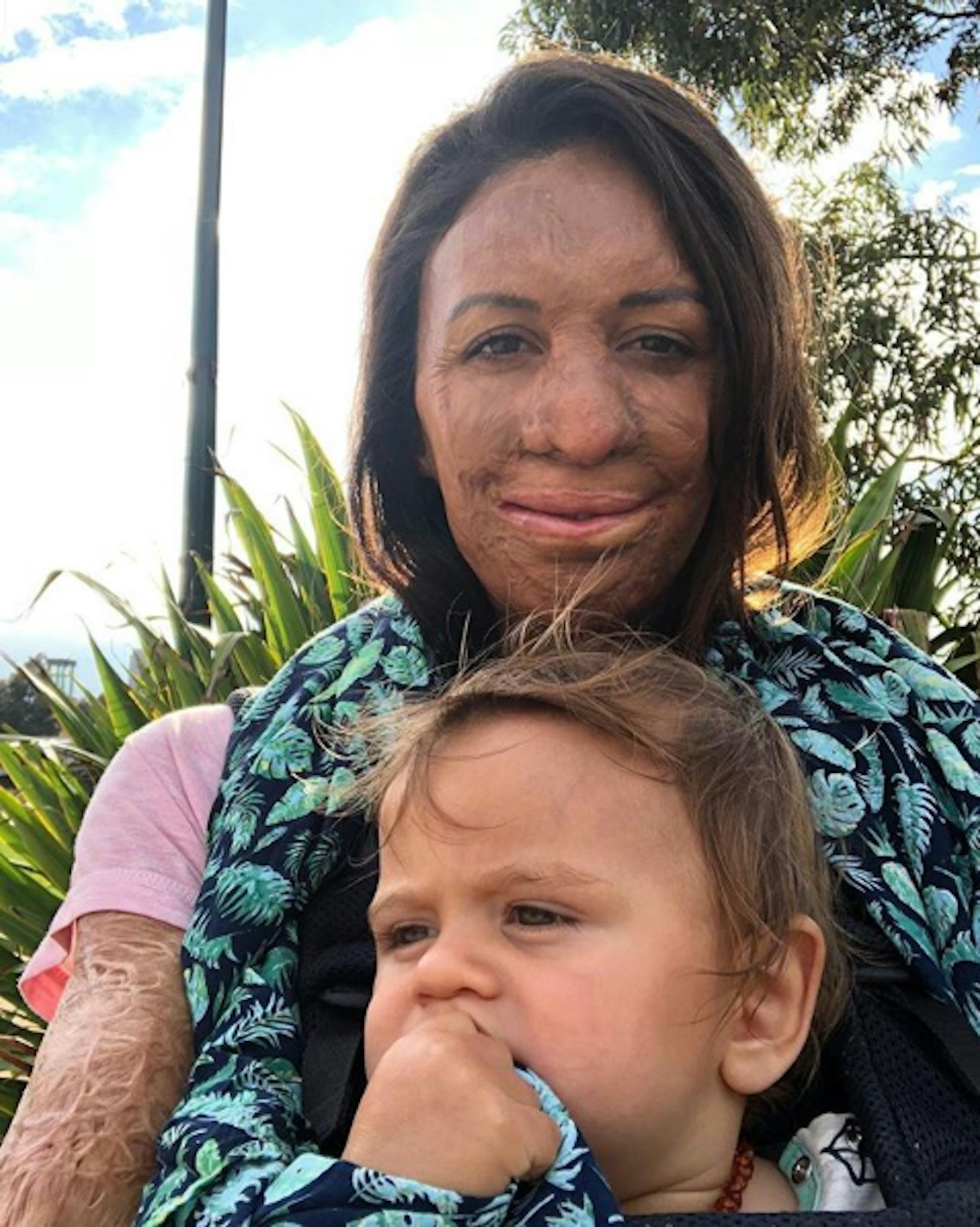 Turia Pitt