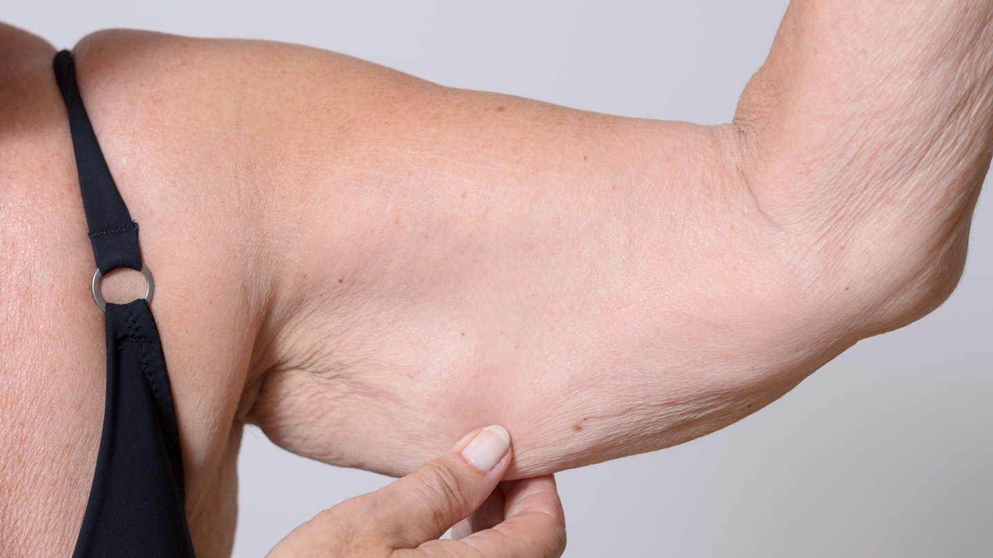 Woman pinching skin under her arm
