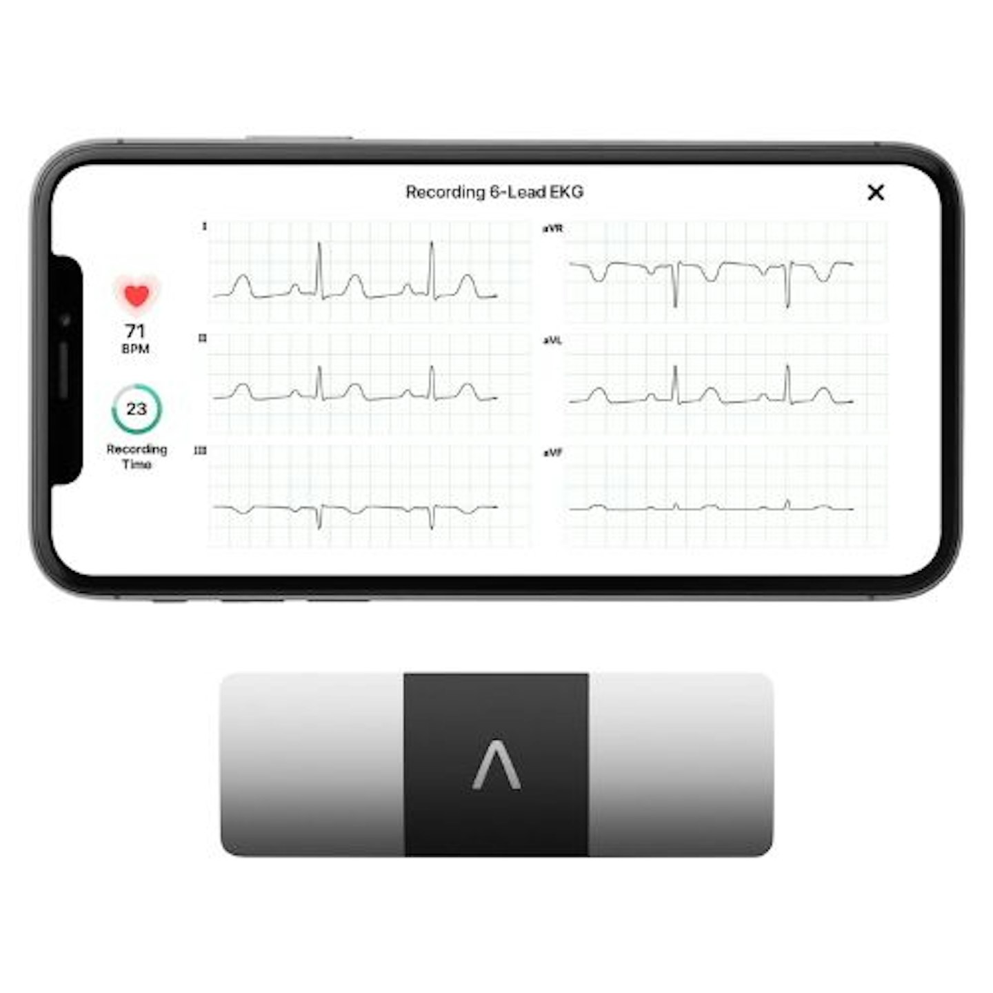 KardiaMobile Personal EKG Device