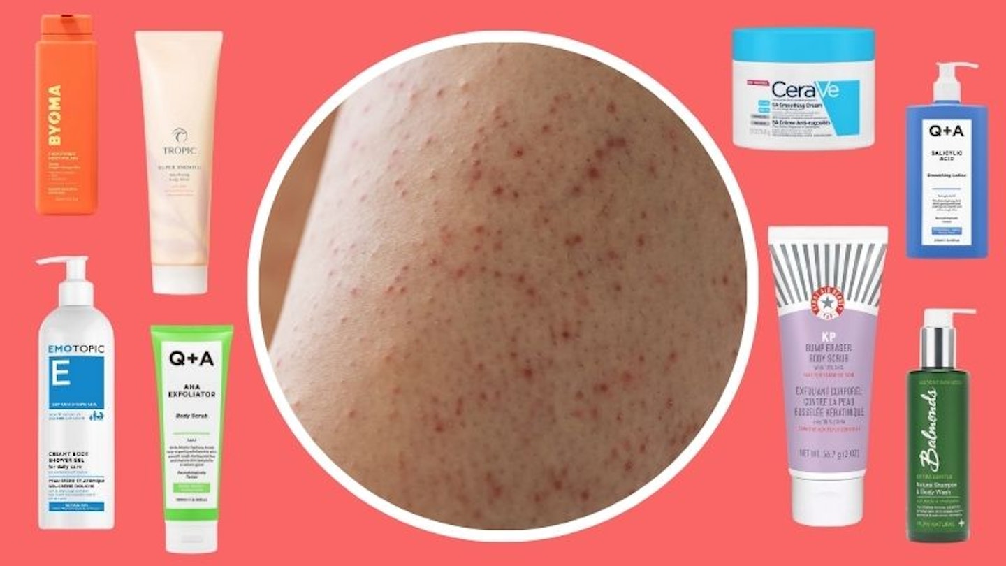 Best Keratosis Pilaris Treatment I ve Tried UK 2024 best-keratosis-pilaris-treatment-i-ve-tried-uk-2024