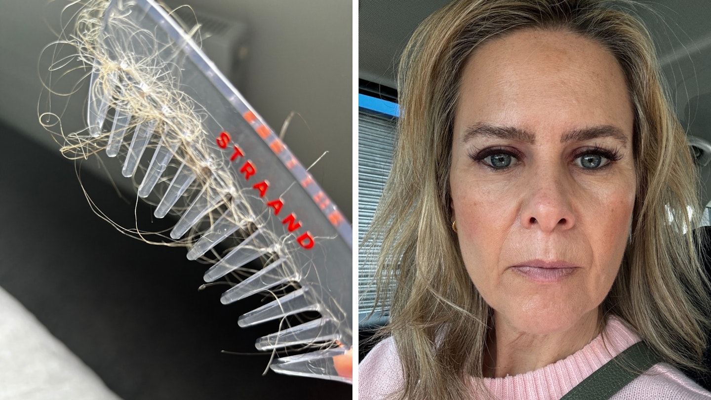 Hair in hairbrush in one image, and woman with normal hair in another image