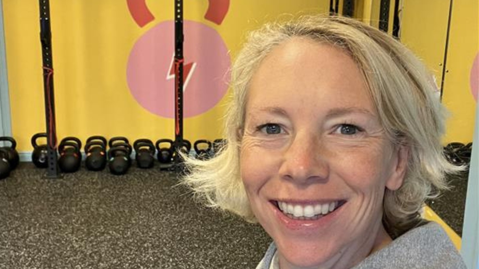 After Invisalign treatment