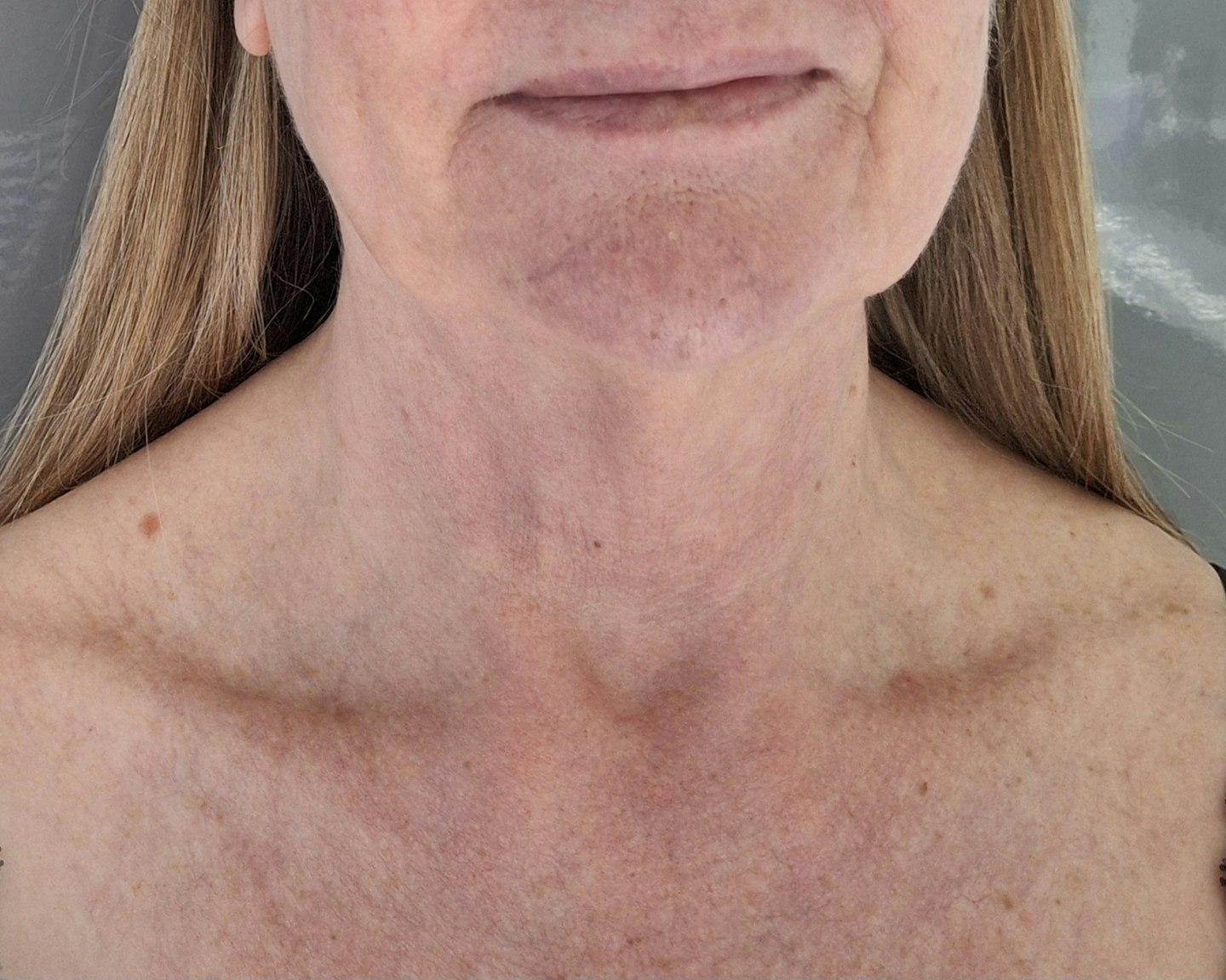 Tester after using the Vichy Neovadiol Phytosculpt Face and Neck Cream