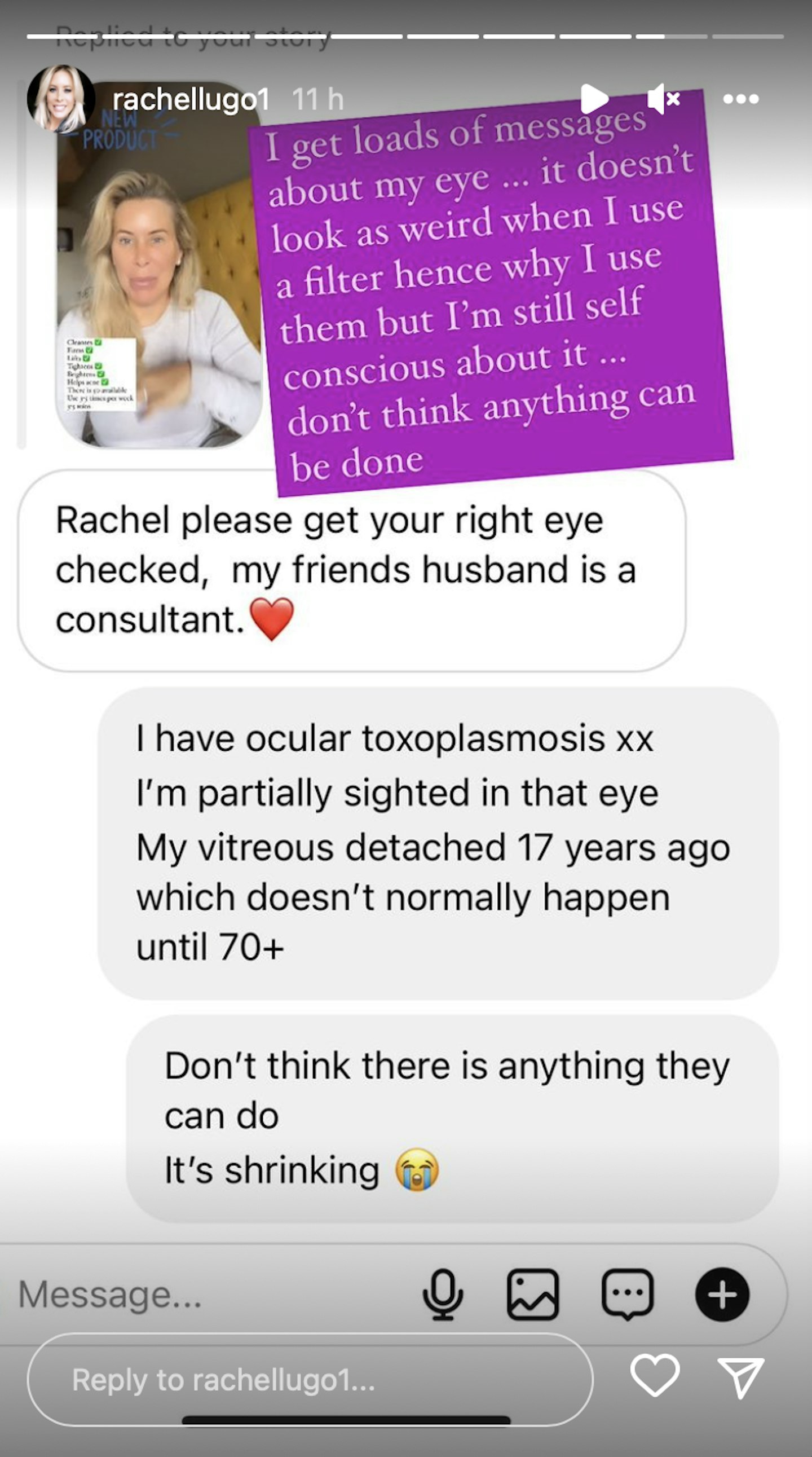 rachel lugo toxoplasmosis