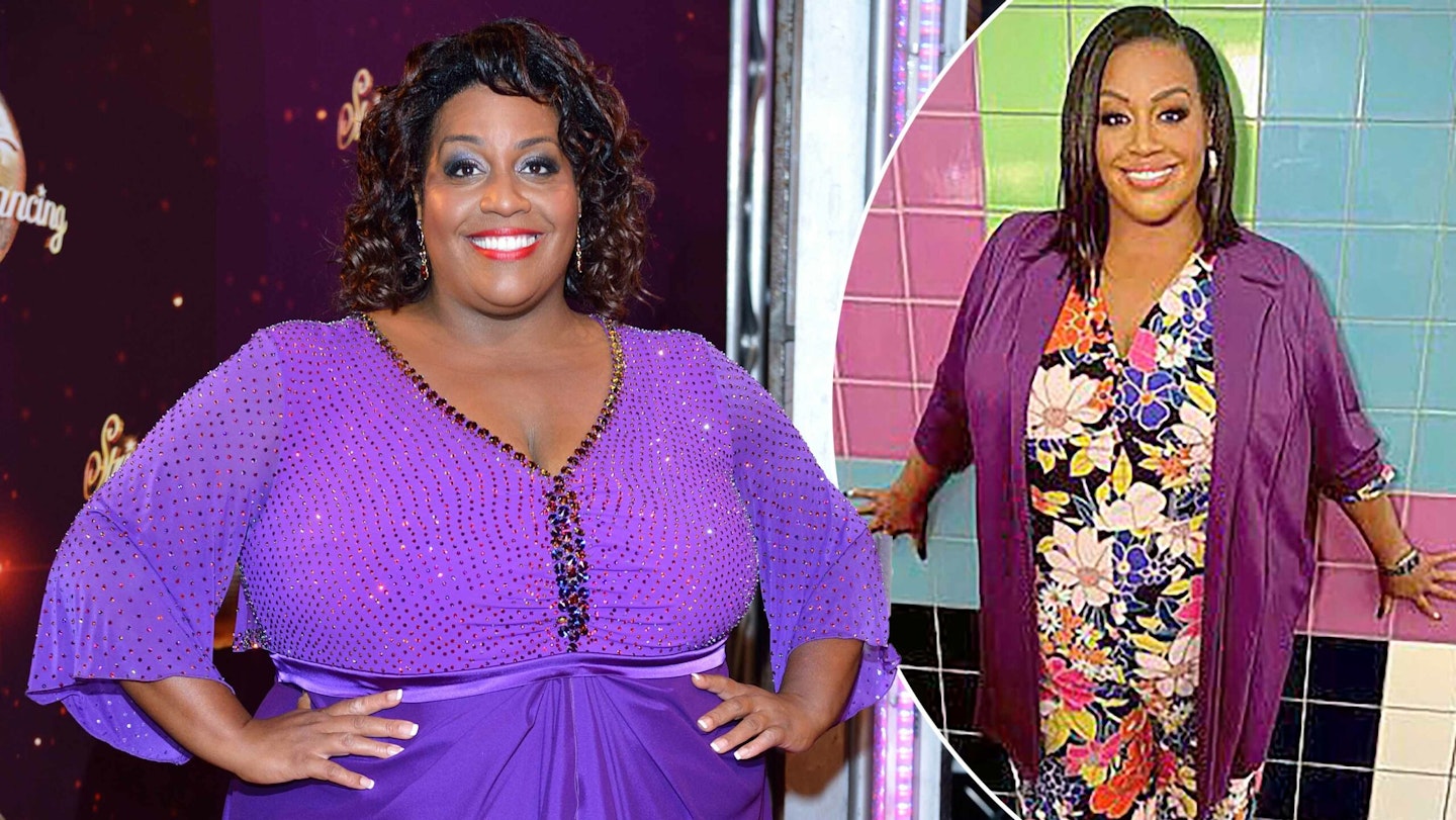 alison hammond before after