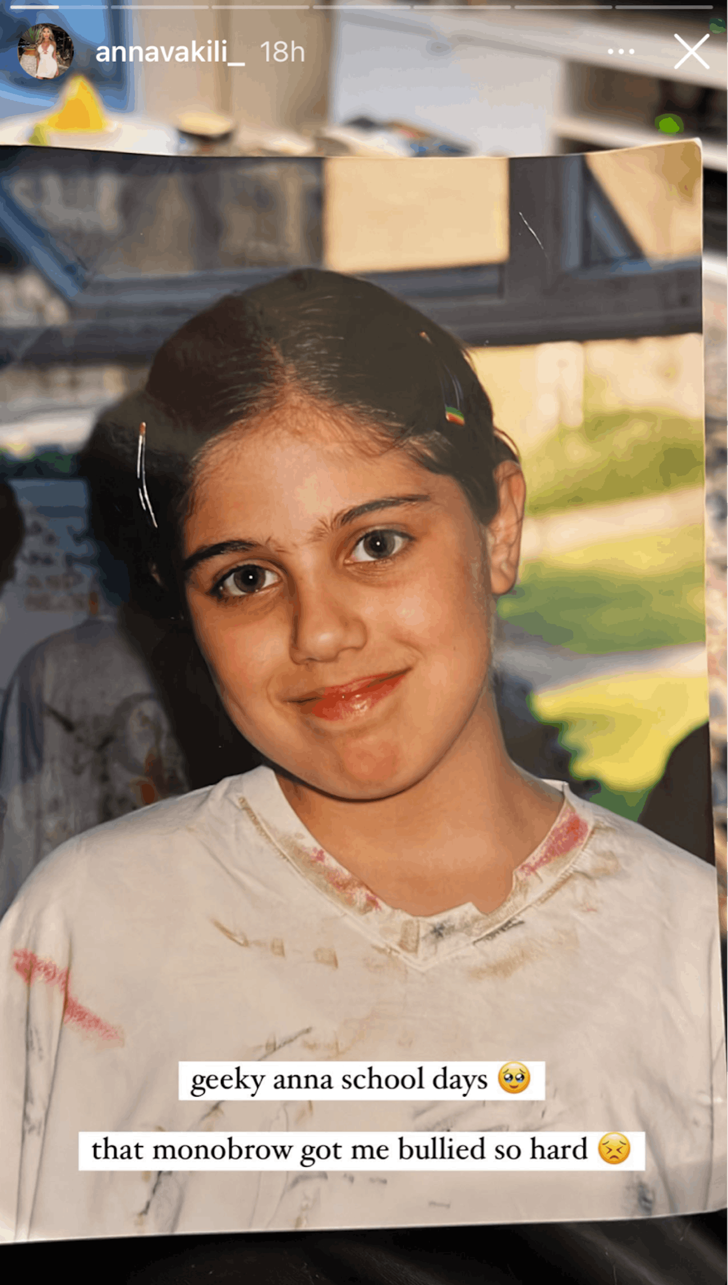 Anna Vakili's throwback photo of her as a child