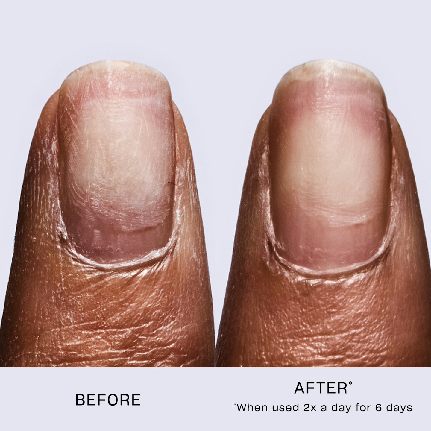 OPI-treatment-nail-repair-before-and-after