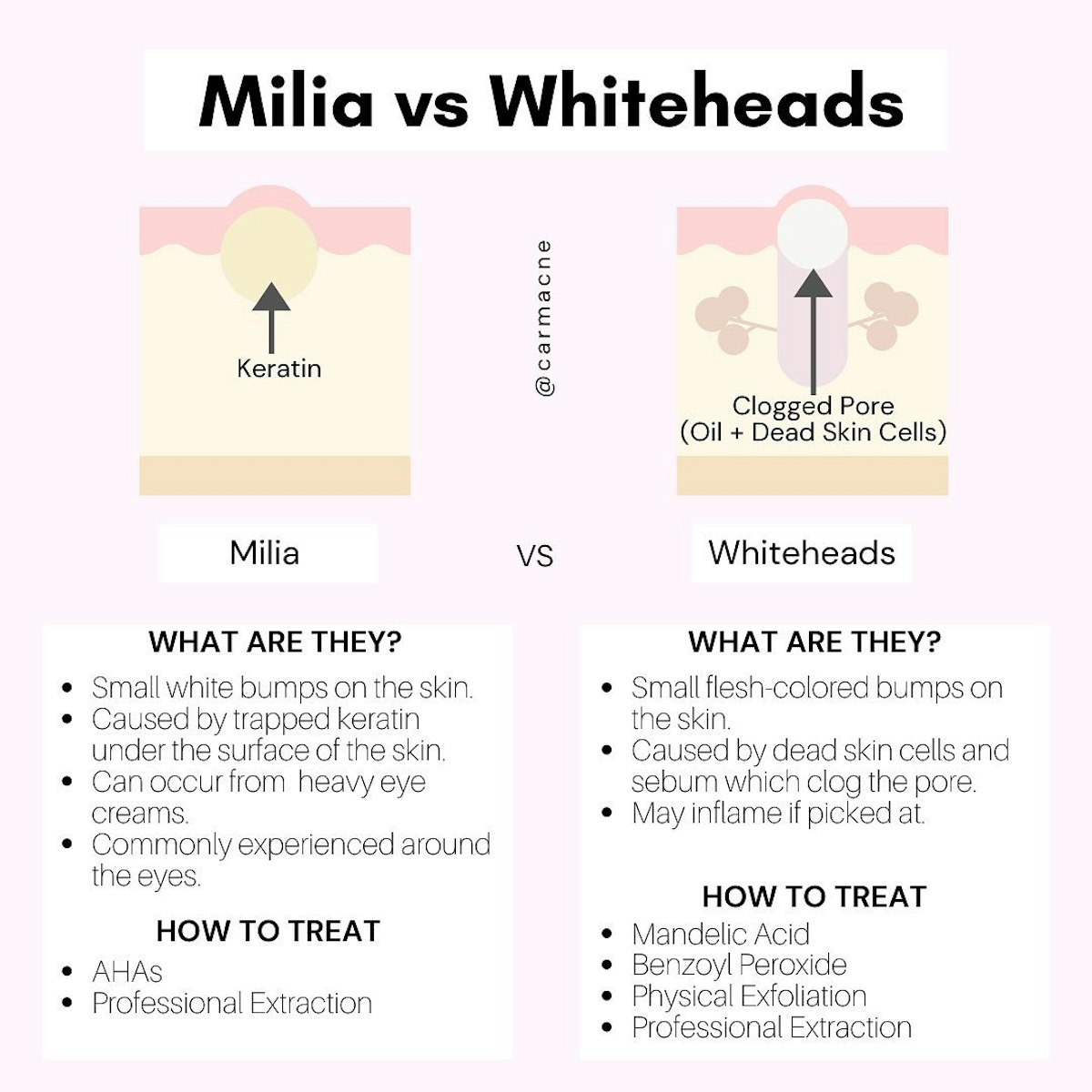 how-to-get-rid-of-whiteheads-the-dermatologist-approved-advice-you