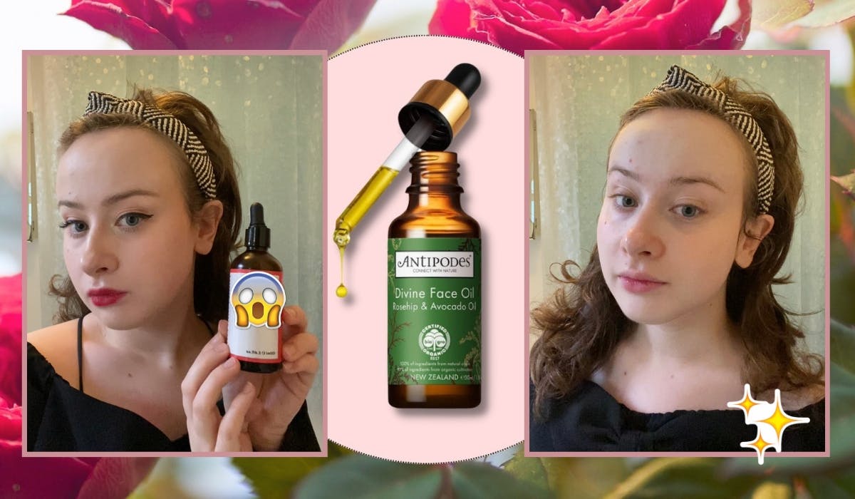 The Best Rosehip Oils And Why It Is The Best Makeup Remover