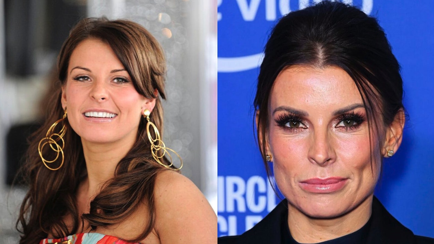 coleen rooney before and after