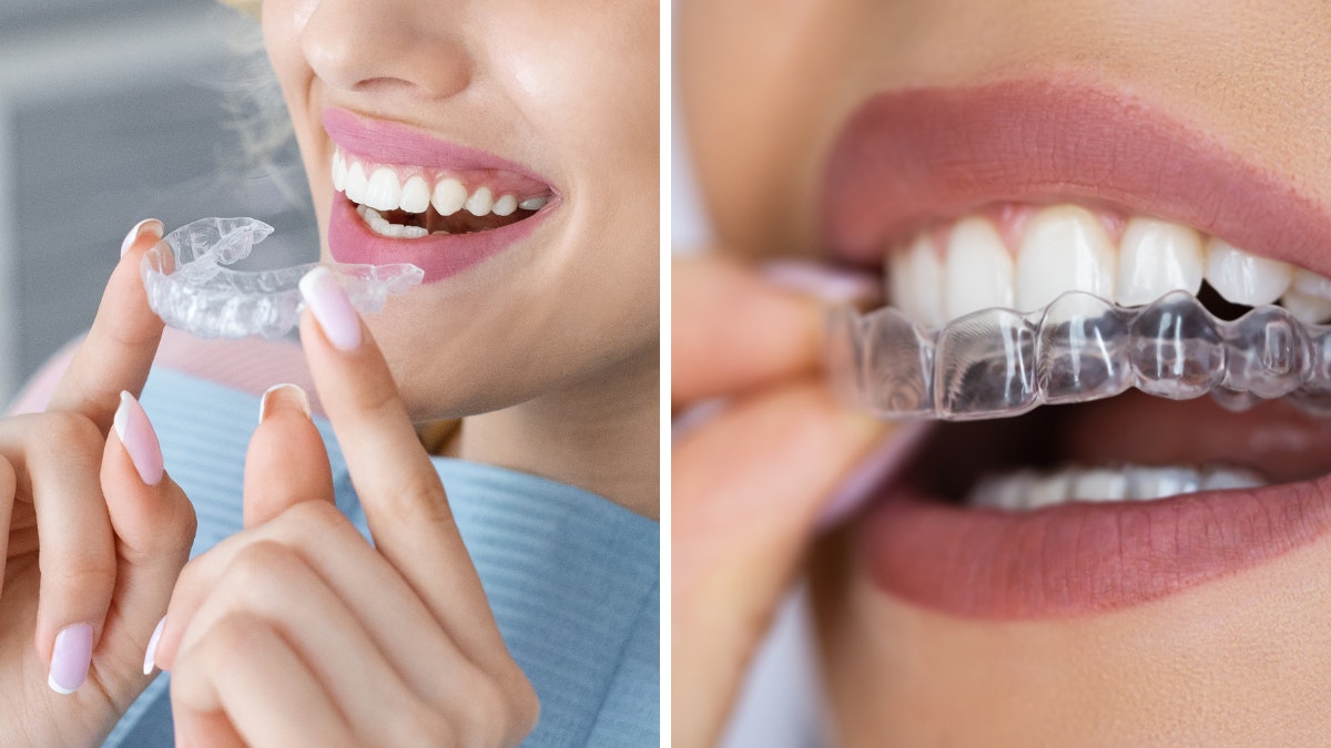 What is Invisalign? Here's Everything You Need To Know According To A ...